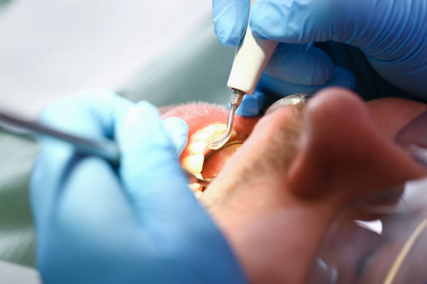 Best Orthodontic Emergency Dentist in Gibsonburg, OH